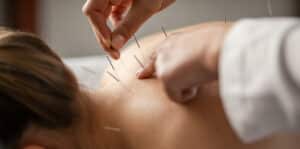 Acupuncture, acupuncture cedar mill, acupuncture portland, acupuncturist, portland acupuncturist, beaverton acupuncture, acupuncture beaverton